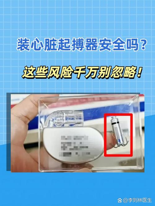 预测性维护：PaaS的“心脏起搏器”