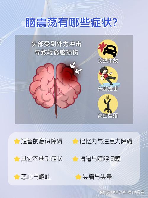 常见故障的振动特征，得刻在脑子里