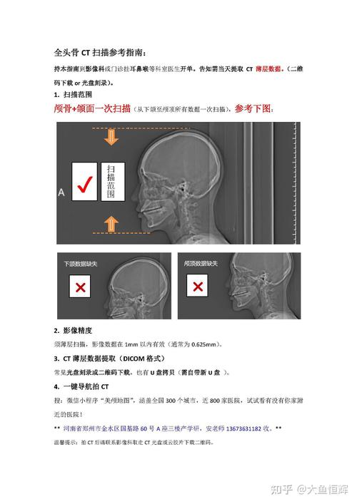 别把VSM当画画,它是CT扫描,不是遗照