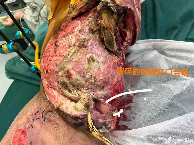 翻车现场：从缩孔到桔皮，痛不欲生