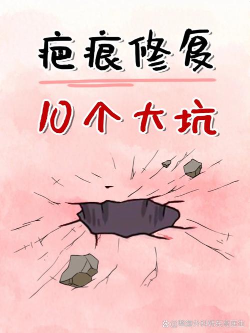选型时的两个大坑，踩过的人不想说话