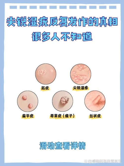 QA环节：你关心的几个尖锐问题