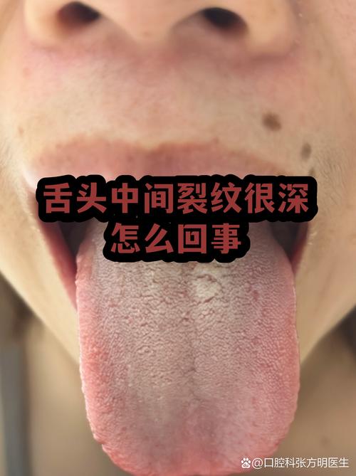 裂纹——这是真要命
