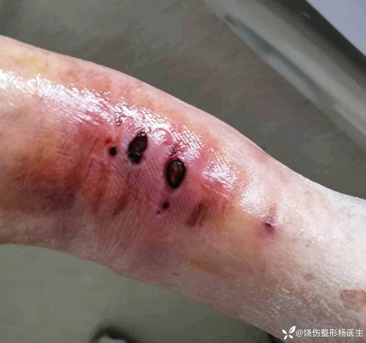 工艺链的暗坑,踩过才知道疼